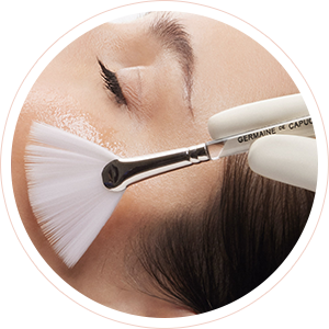 Peeling superficiel