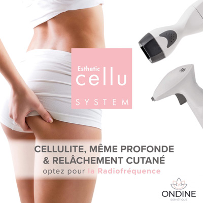 Radiofréquence cellulite