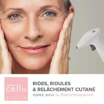 Radiofréquence rides